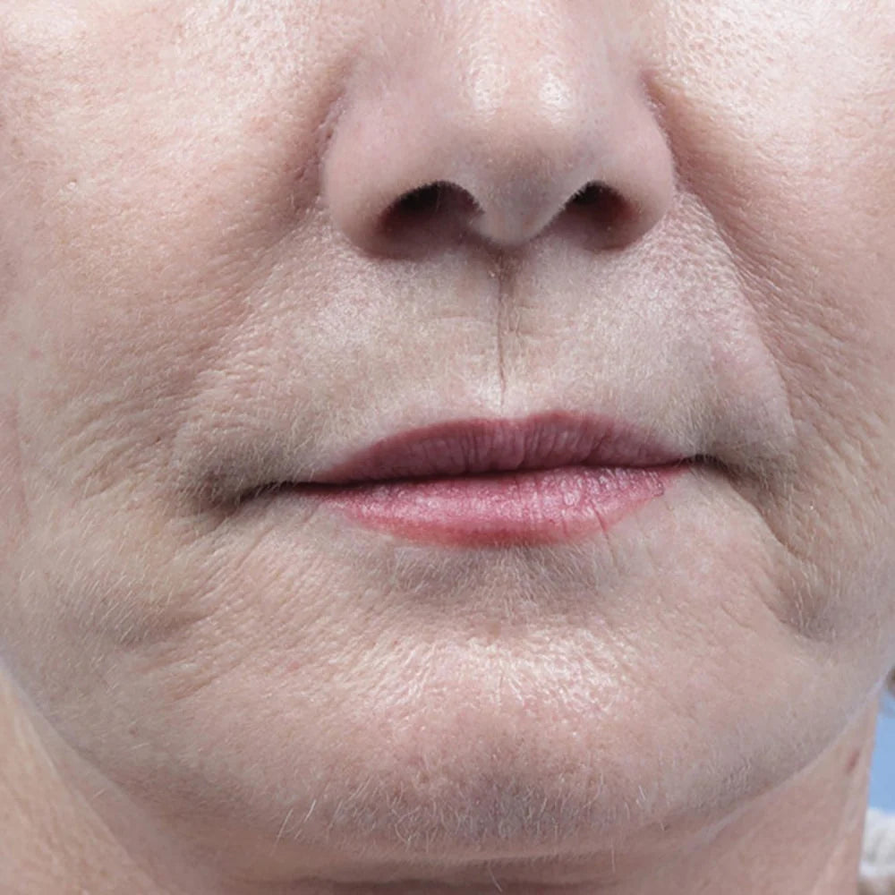 Huid na consistent gebruik van HENDIA Face Oil