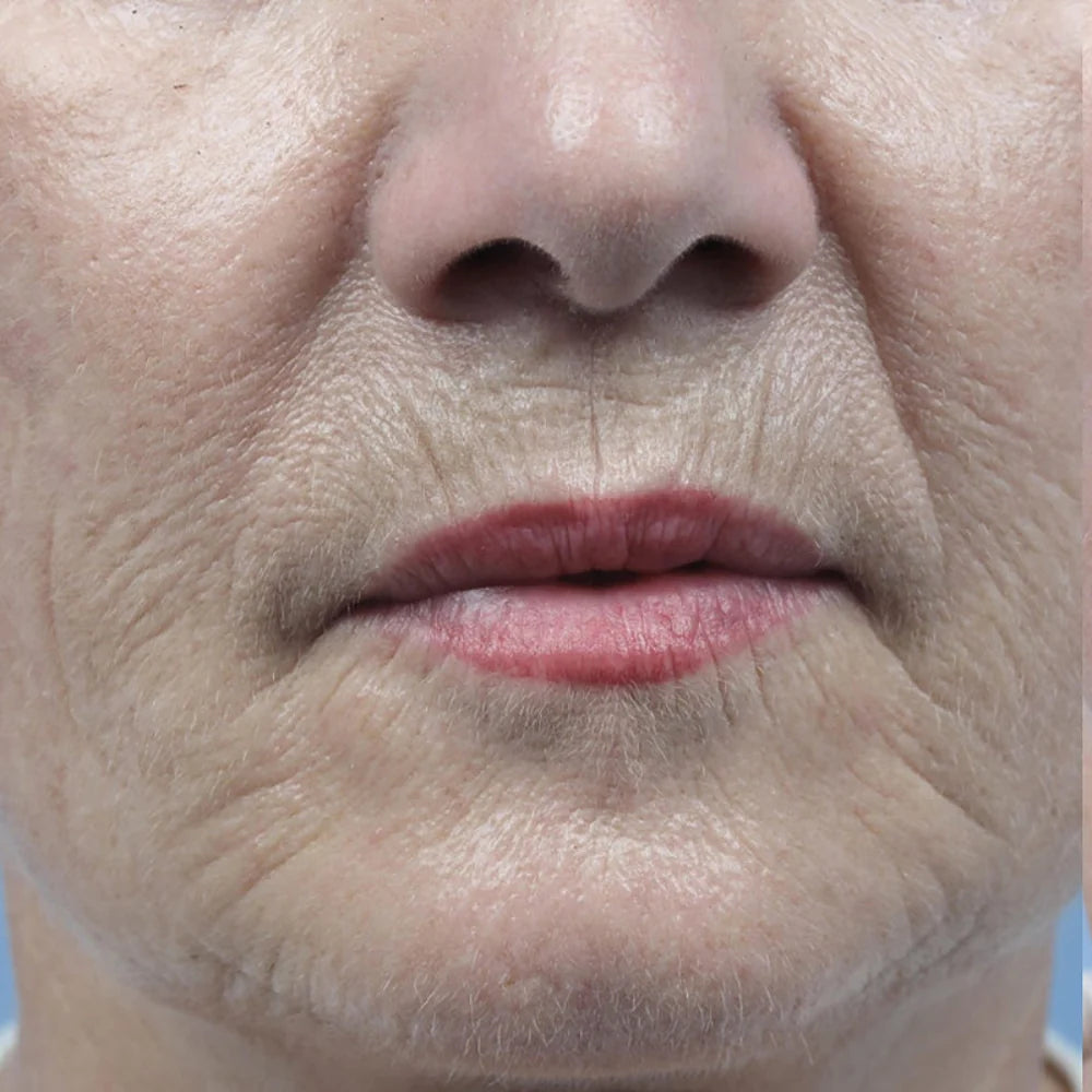 Huid voor het gebruik van HENDIA Face Oil